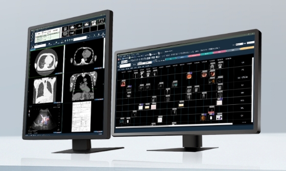 画像ファイリングシステムPACSのイメージ画像