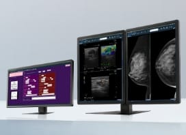 マンモグラフィワークステーションのイメージ画像