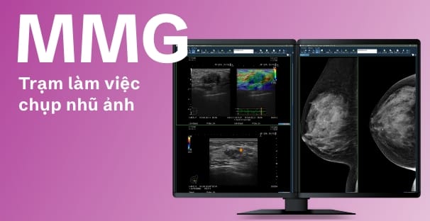 MMGマンモグラフィワークステーションのイメージ画像