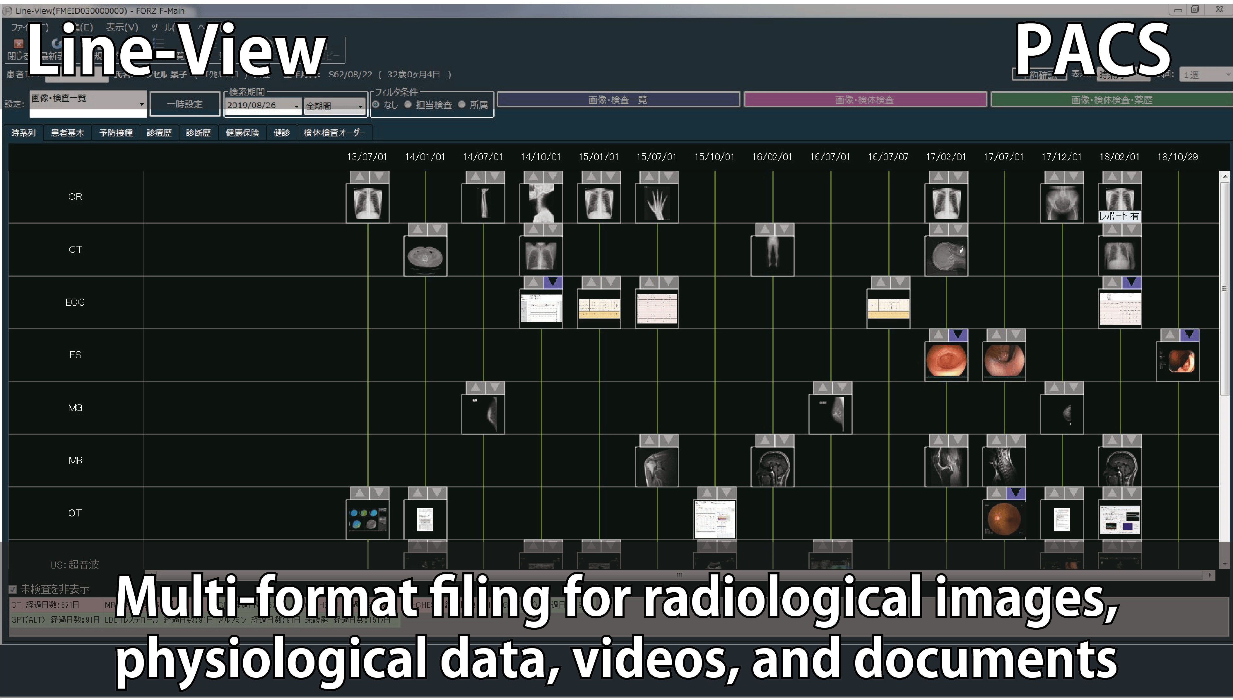 マルチモダリティ統合PACSのLine-Viewのイメージ画像