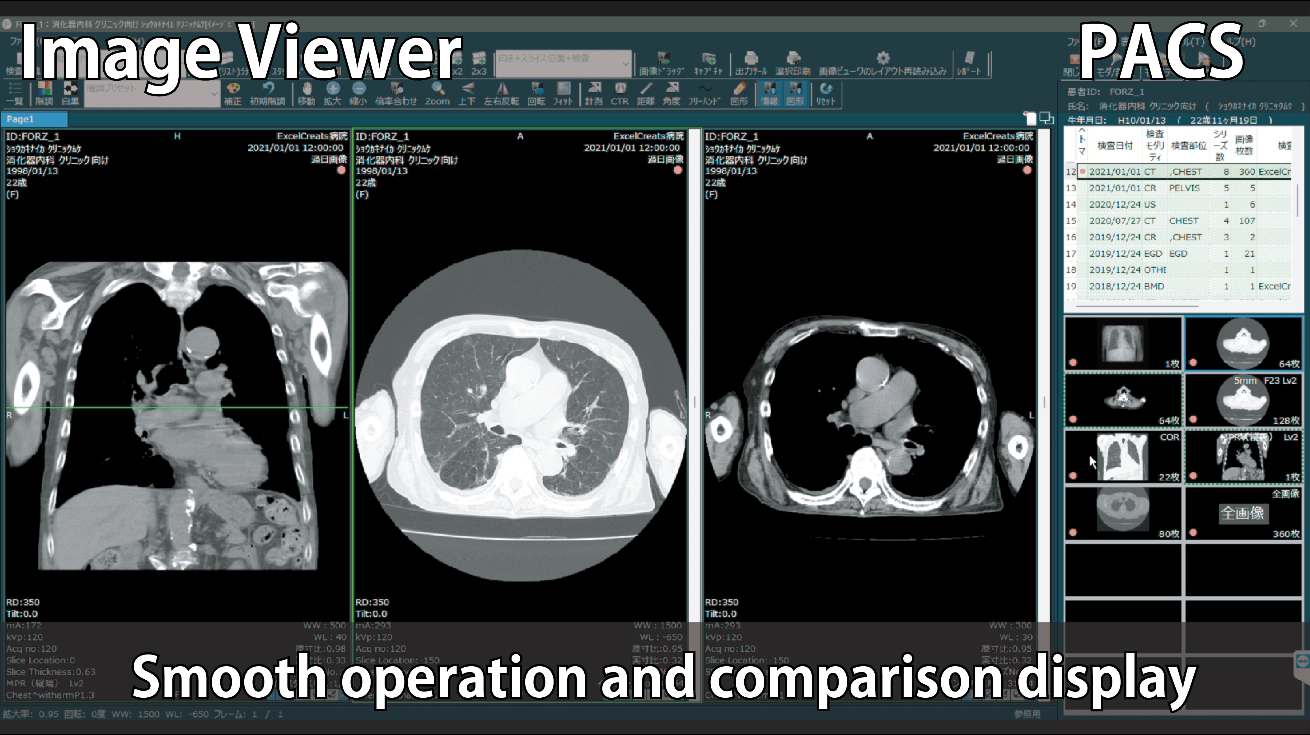 マルチモダリティ統合PACSのイメージビューワーの操作性や比較表示のイメージ画像