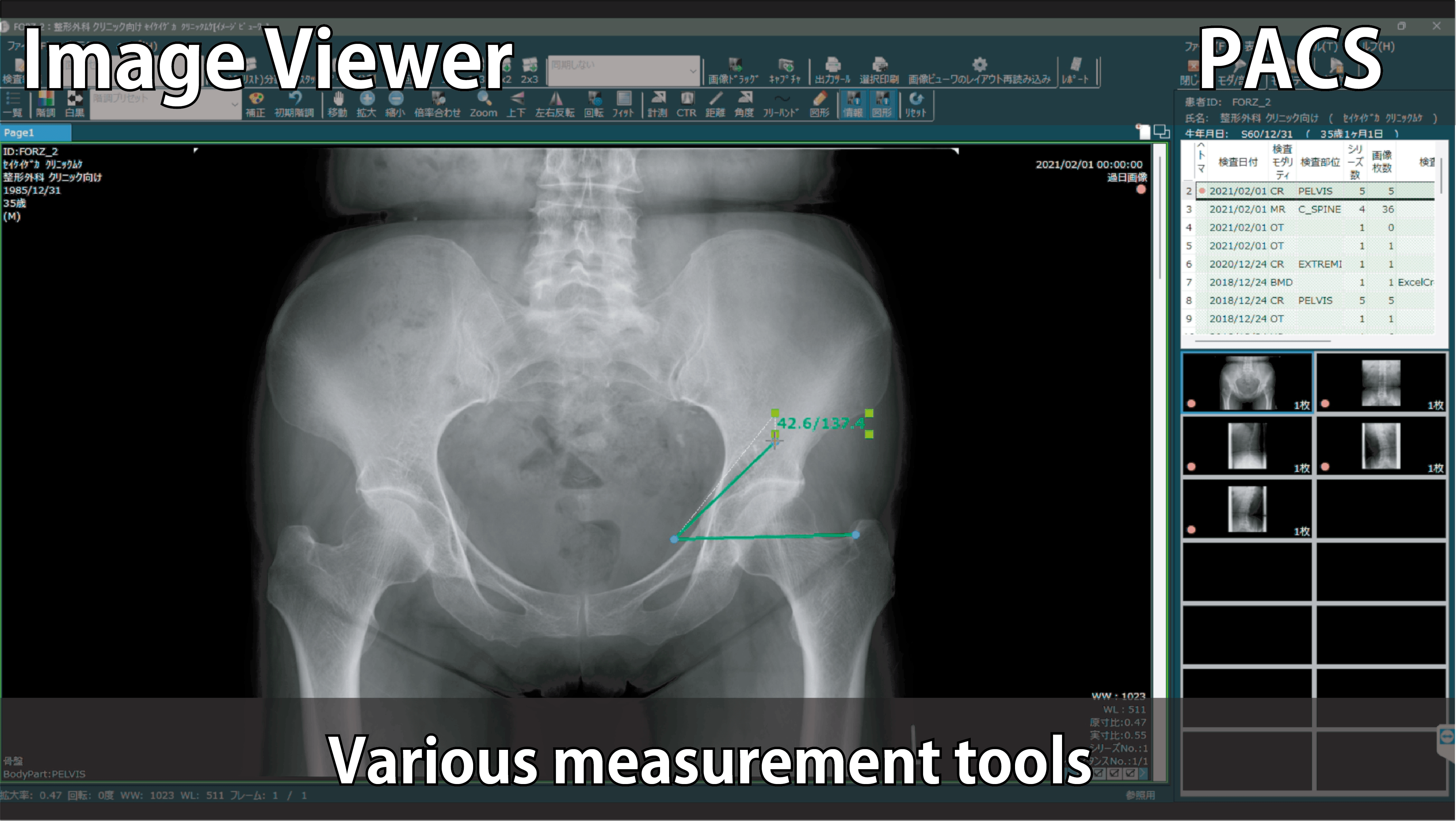 マルチモダリティ統合PACSのイメージビューワーの計測機能のイメージ画像