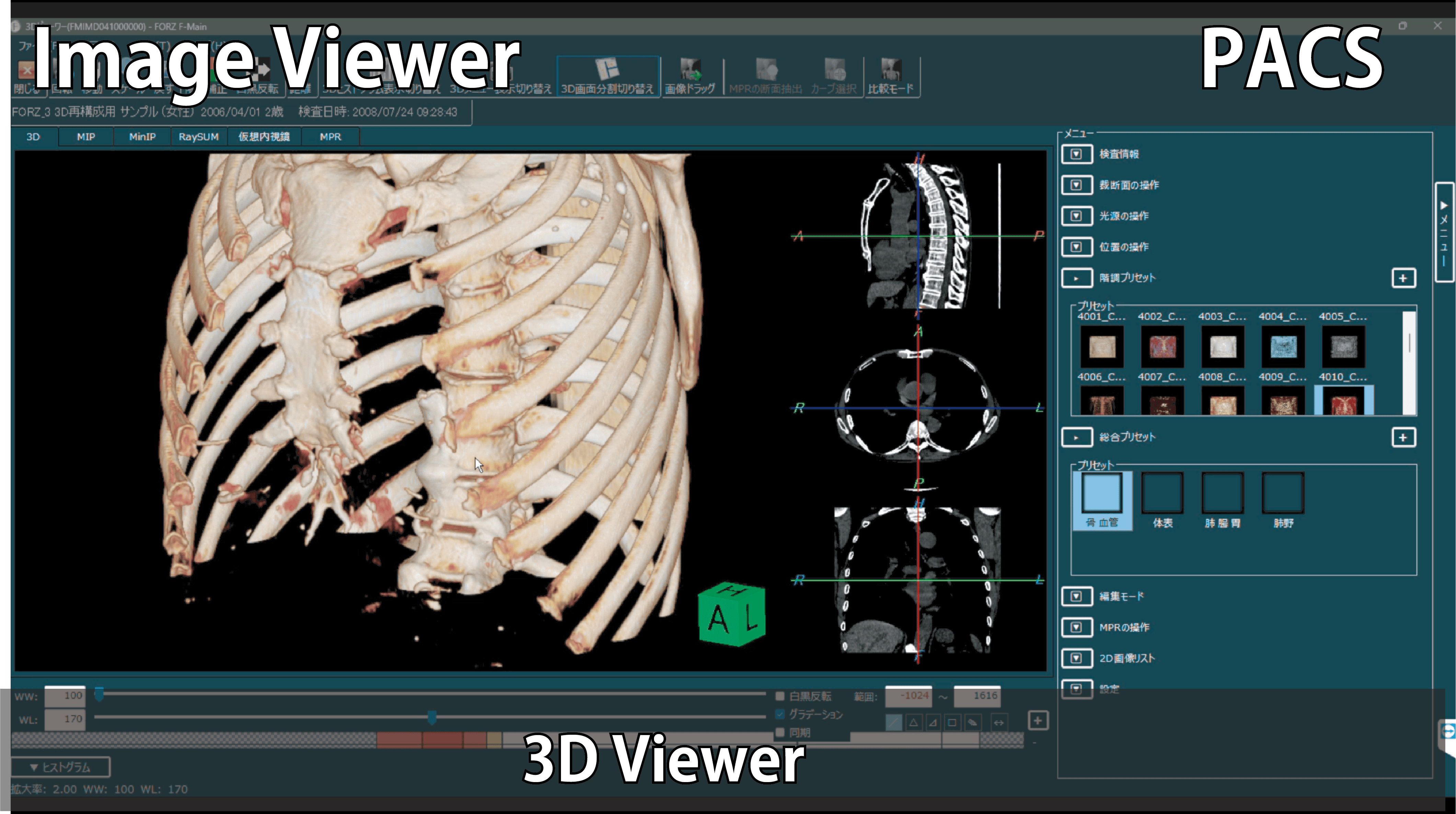 マルチモダリティ統合PACSの3Dビューワーのイメージ画像