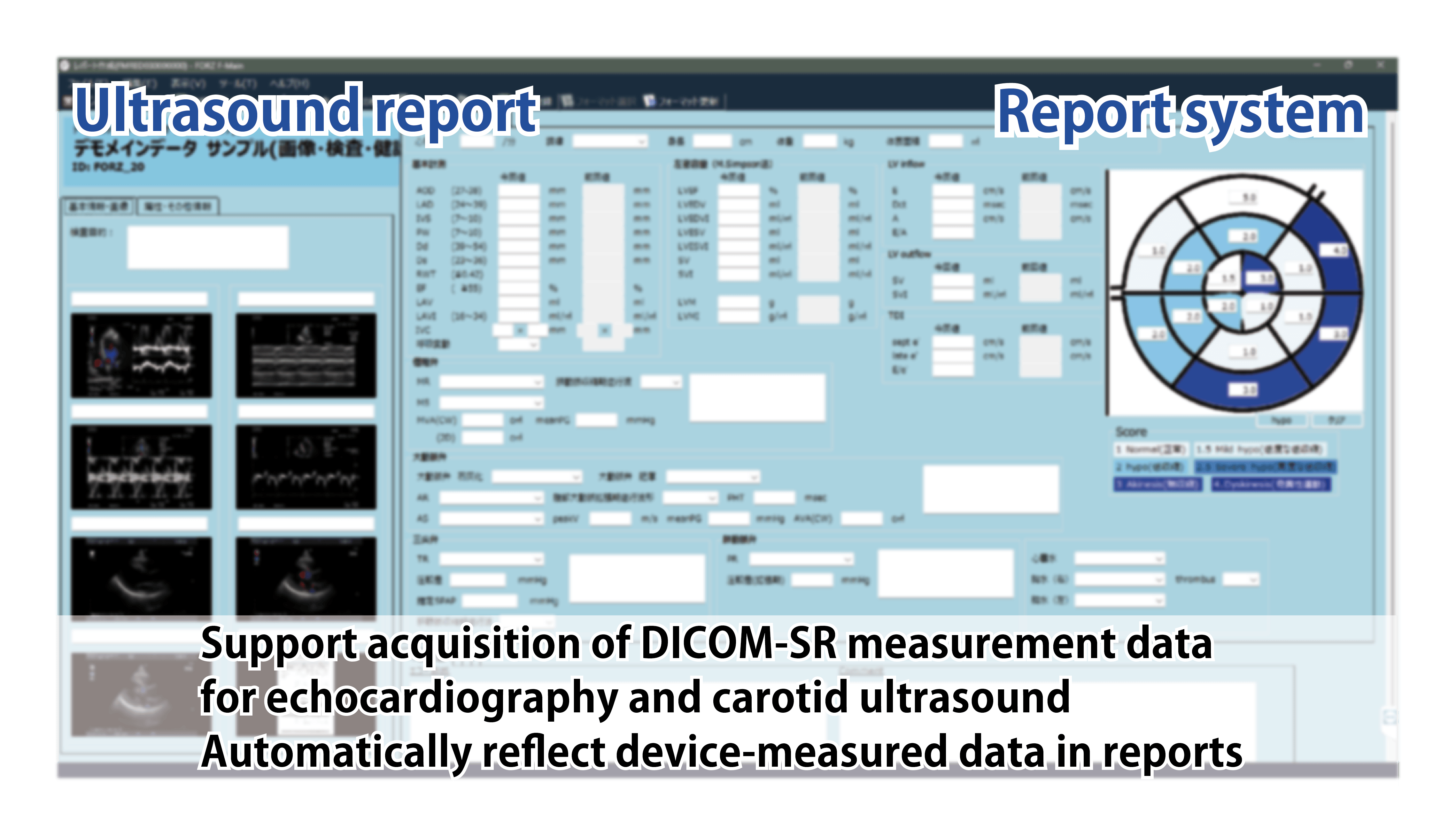 レポートシステムの超音波レポートイメージ画像