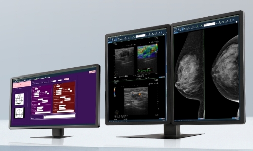 マンモグラフィビューワーのイメージ画像