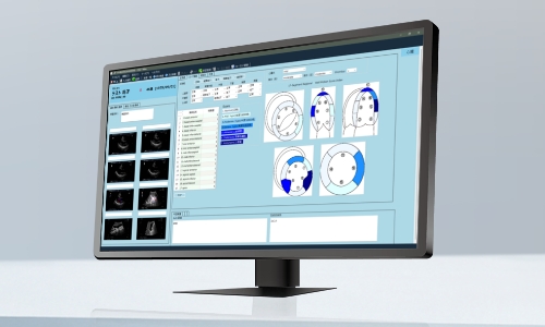 超音波レポートシステムのイメージ画像