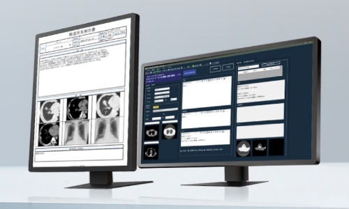 遠隔読影サービスのイメージ画像