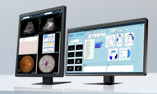 生理検査システムのイメージ画像