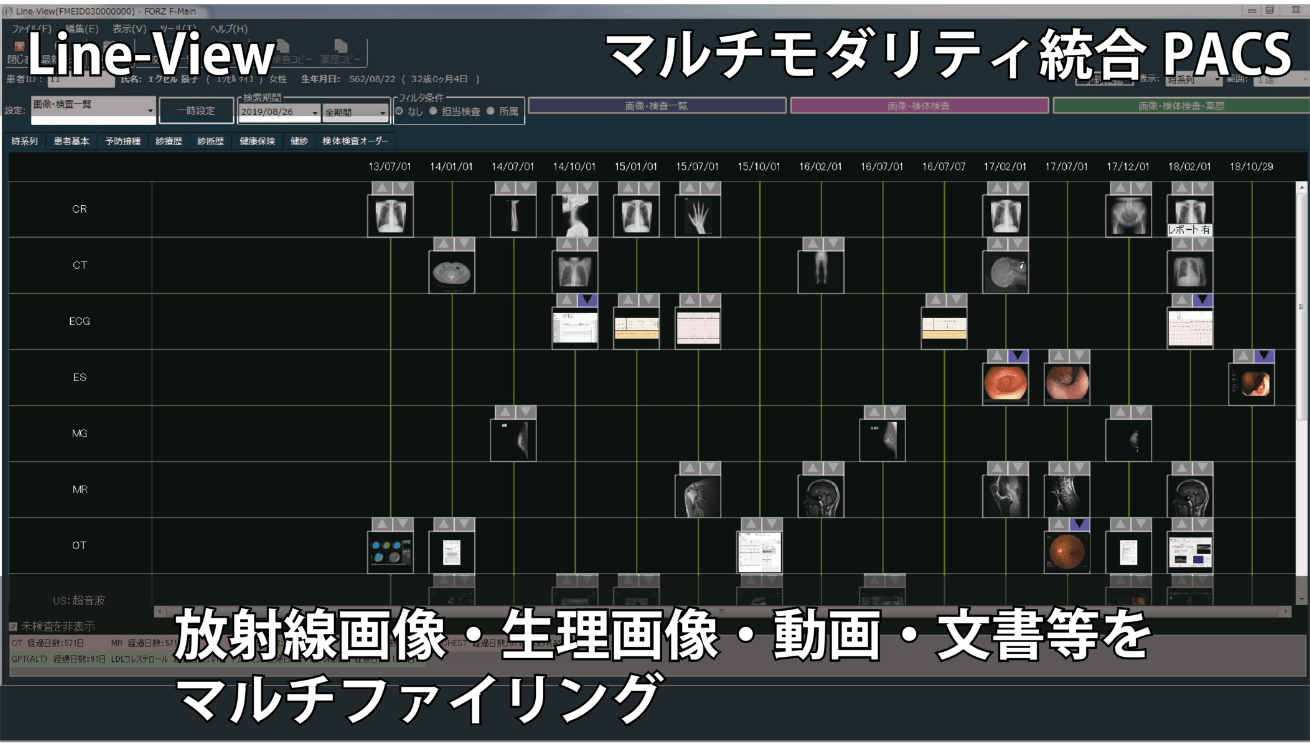 マルチモダリティ統合PACSのLine-Viewのイメージ画像