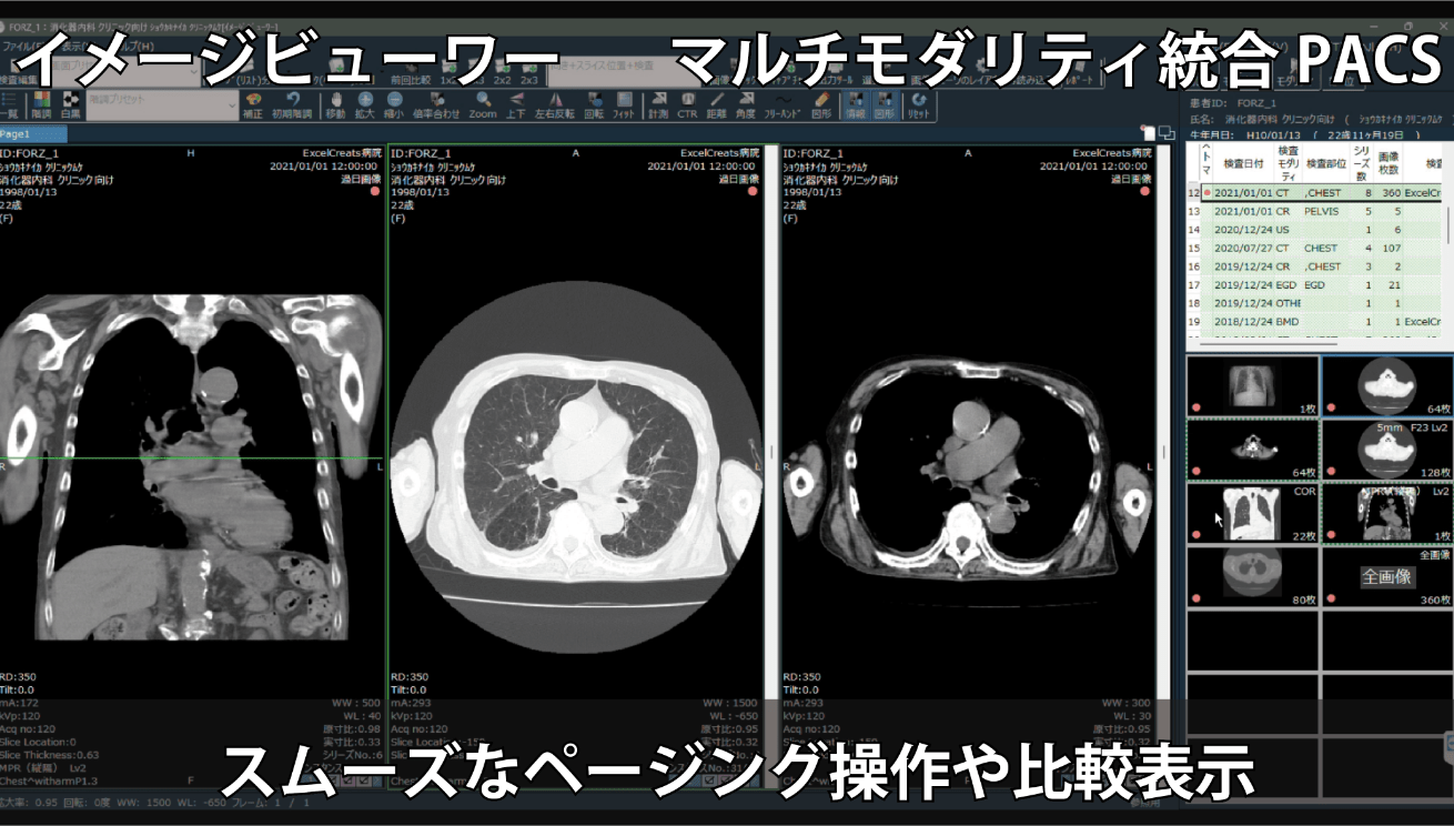 マルチモダリティ統合PACSのイメージビューワーの操作性や比較表示のイメージ画像