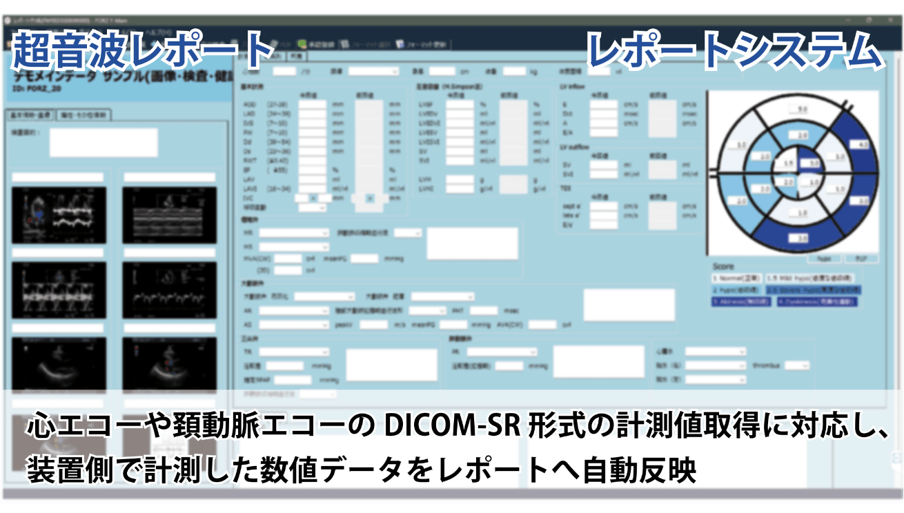 レポートシステムの超音波レポートイメージ画像