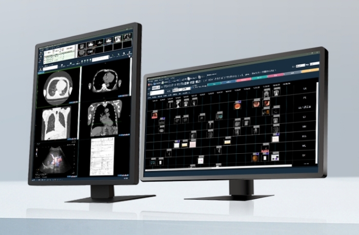 マルチモダリティ統合PACSのイメージ画像