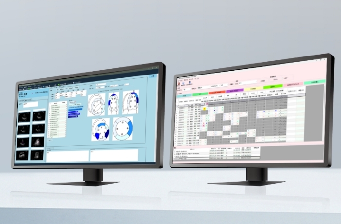臨床検査システムのイメージ画像