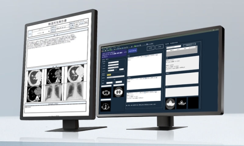 遠隔読影サービスのイメージ画像