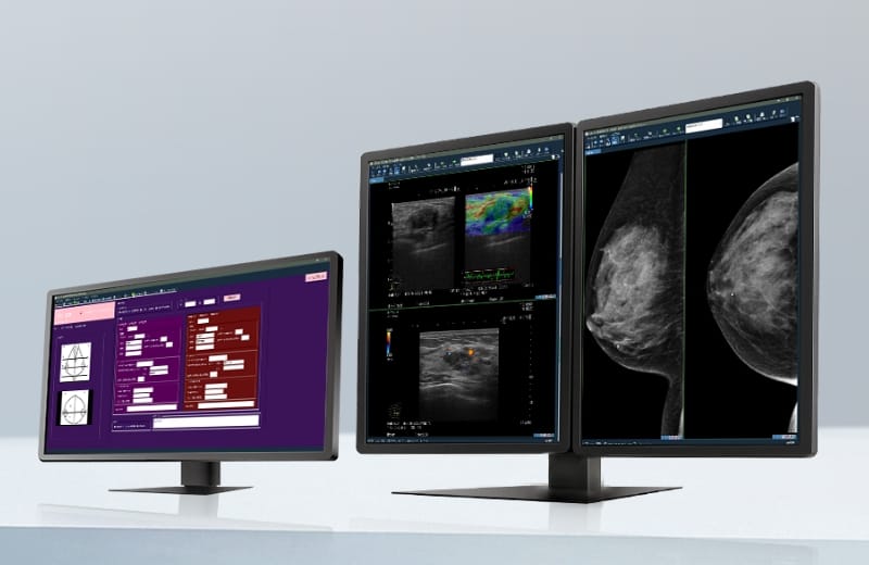 マンモグラフィワークステーションのイメージ画像