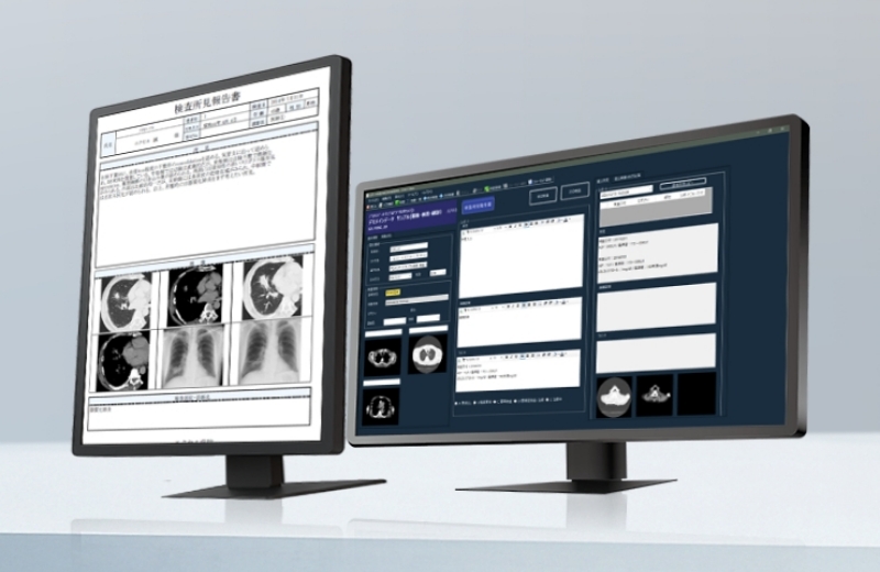 遠隔読影サービスのイメージ画像