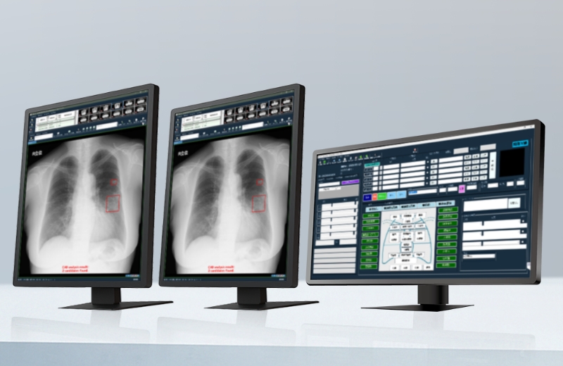健診用PACS/レポートシステムのイメージ画像