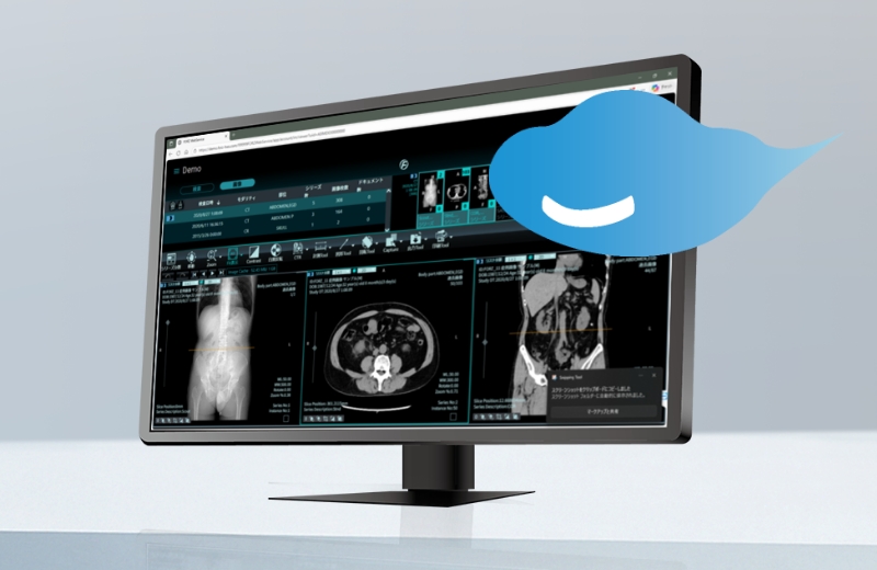 クラウドPACSのイメージ画像