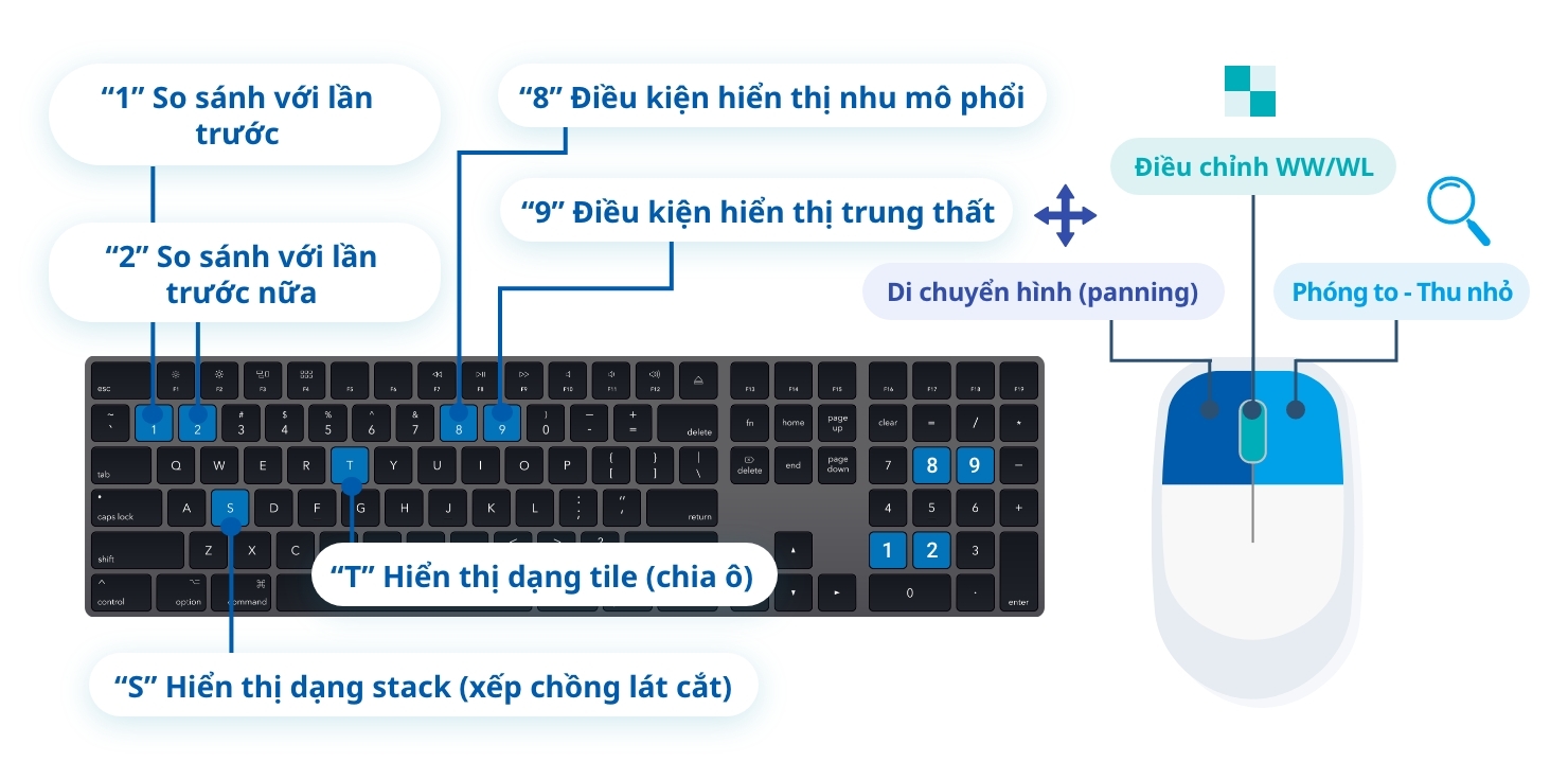 V&iacute; dụ về việc c&agrave;i đặt ph&iacute;m tắt của b&agrave;n ph&iacute;m v&agrave; con chuột cho c&aacute;c thao t&aacute;c tr&ecirc;n PACS