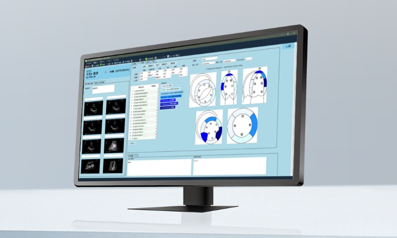 レポートシステムで入力支援機能を活用できるイメージ画像