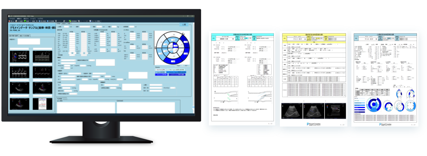 超音波レポートシステムの画面イメージと計測した数値データ出力イメージの画像