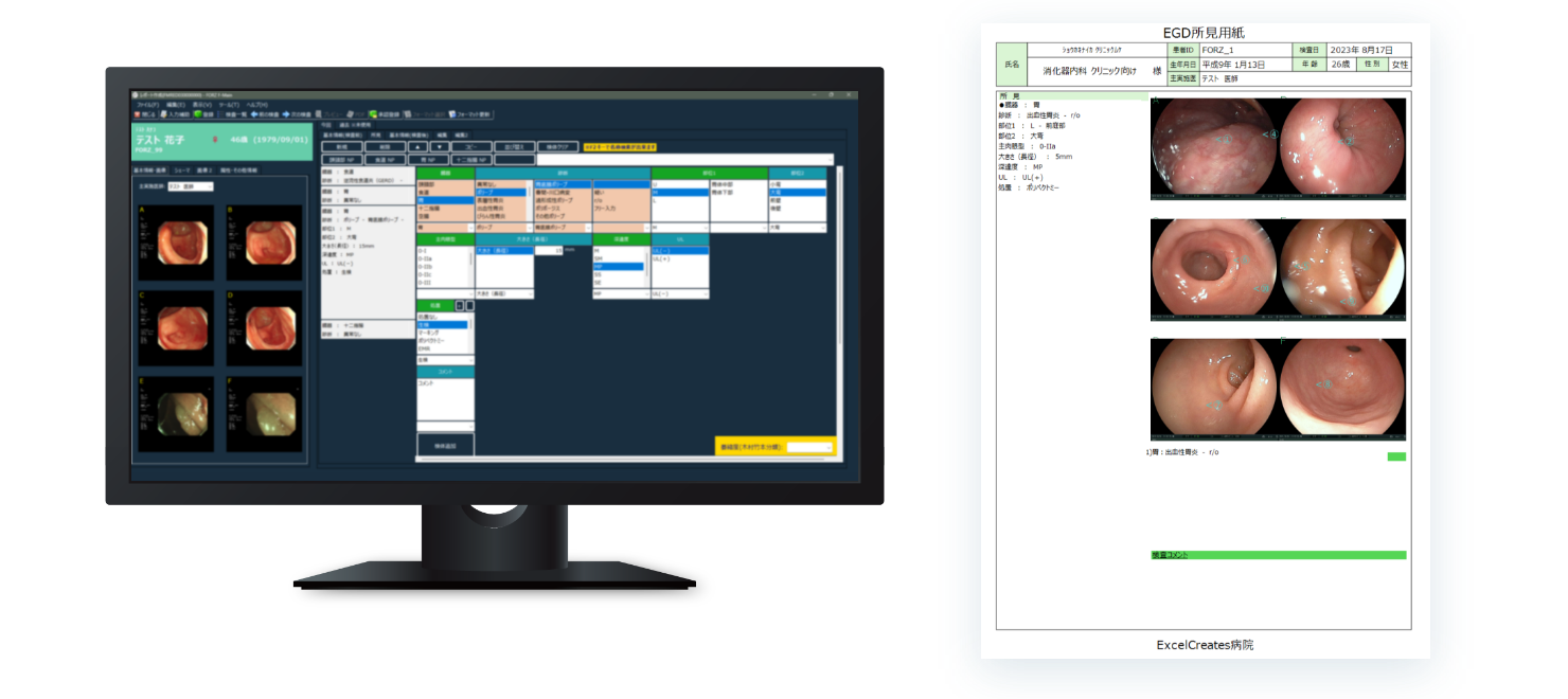 内視鏡レポートシステムの画面イメージとレポート出力イメージの画像