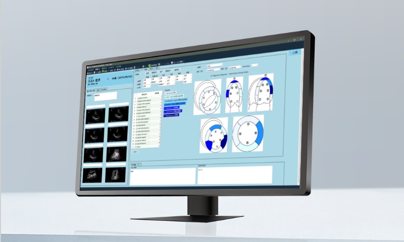 生理検査システムのイメージ画像