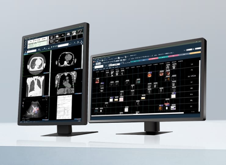 マルチモダリティ統合PACS　画像ファイリングシステムのイメージ画像