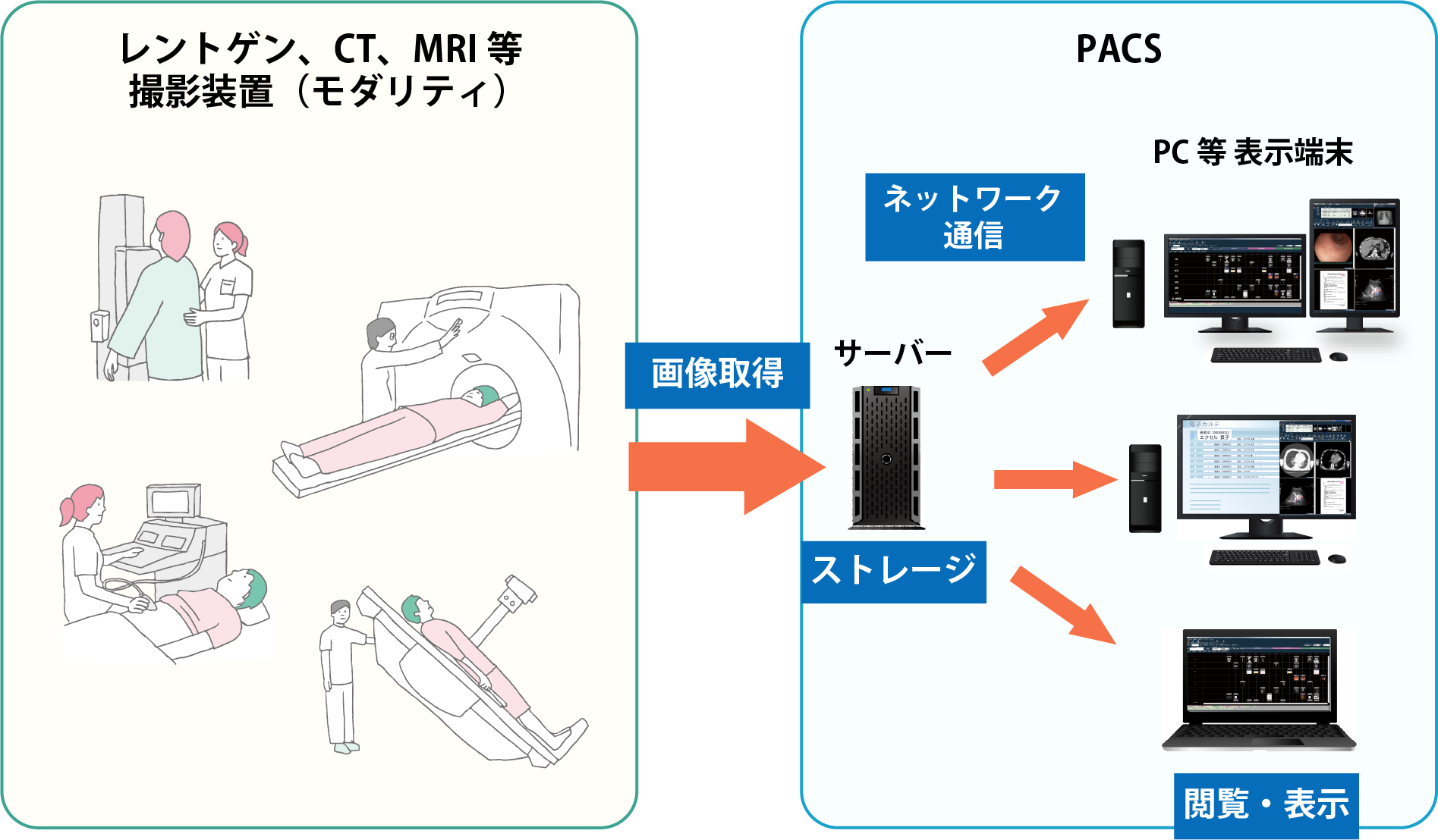 PACSの仕組み